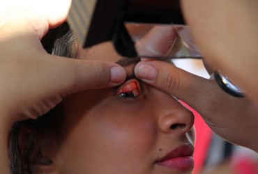 Aluna tem sinal de tracoma
