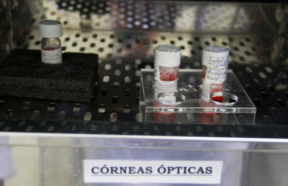 Foram realizados 185 transplantes de córneas em Rondônia