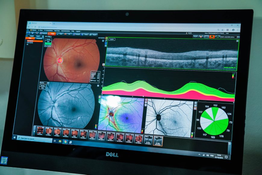 No Dia Nacional de Combate ao Glaucoma, Sesau reforça importância do diagnóstico precoce