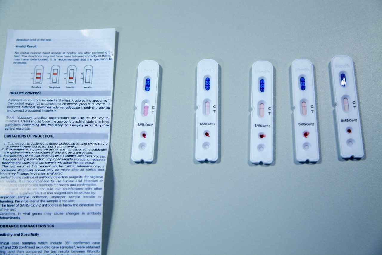 15% dos testes rápidos dão positivo para covid-19 no Brasil - TecMundo