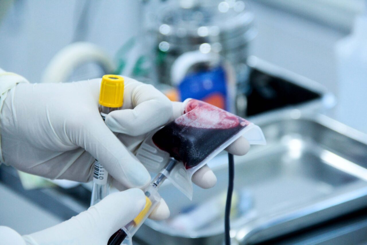 Servidores do Iperon reforçam estoques de sangue em ação promovida na Fhemeron