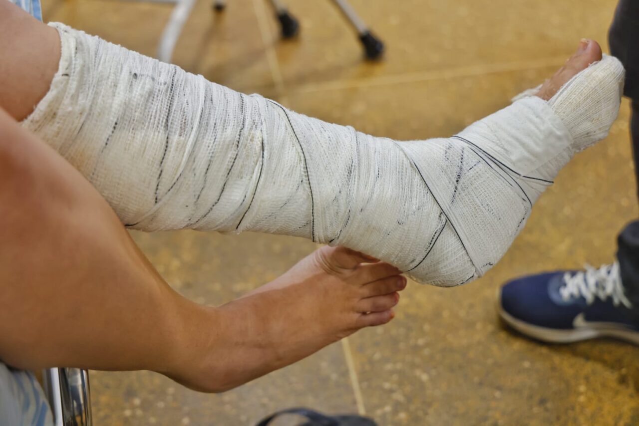 A primeira paciente foi Luana Bianque Scardin que passou por um procedimento cirúrgico no tornozelo